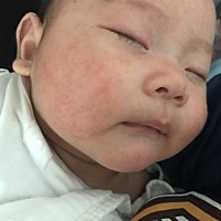 宝妈们，我想问问，宝宝湿疹用什么好呀？看着我宝贝这脸怪心疼的，求宝妈们支招