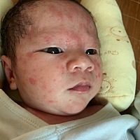 刚出生20天脸上长的这是什么有宝妈知道的吗
