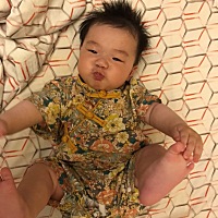 嗨 姐妹们 我想告诉大家注意一下宝宝的身体发育 就是宝宝腿部纹路不一样的 一定要重视 正常宝宝两条腿的...