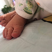 剖腹产后第十天，刀口仍旧有点疼，左边胯骨附近隐隐作痛，但只要看到宝宝天真无邪的笑容就觉得一切都值...