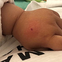 但是有点发红   要不要去医院啊   求助求助   怎么办   要不要紧？？？