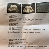 四个月检查出肝内钙化，肝俩边高回声，有类似的吗？胎儿能否要？
