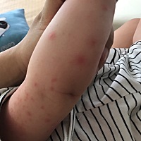 宝宝七个半月，昨天突然手臂上长了这些红点，天气太热长了一些痱子，但这些红点不知道是什么