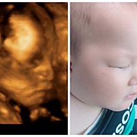 时间好快 现在都八个月了 10.2公斤  74.2公分