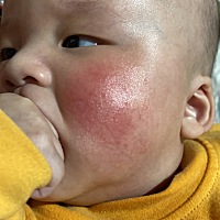 宝妈们，我想问一下宝宝最近脸特别干又红，擦保湿霜也没什么用，怎么办呢？看他脸好可怜🥺