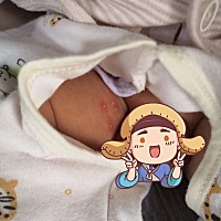 最近天气炎热 这是什么问题？ 涂了婴宝两天，没长其他 但是变成浓泡 孩子睡觉也难熬