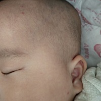 昨晚宝宝成功被蚊子亲了三口！！！