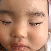 亲们有没有人会看七个月的宝宝发烧三天了今天早晨脸上出小红点点这属于幼儿急疹吗？