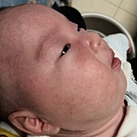 可以用什么缓解