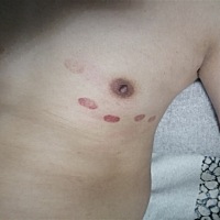 这是怎么弄的？有知道的吗？