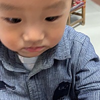 宝爸抽烟时候没看到，宝宝头被烟头烫伤，有什么好的办法不让留疤？求推荐