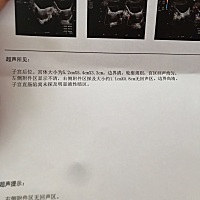 今天B超检查医生说我右侧附件可能是囊肿这个要怎么治疗啊😱