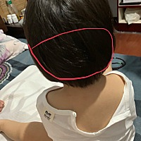 这个地方挠来挠去的