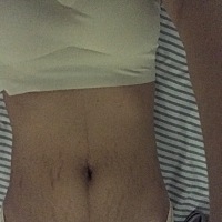 产后5个月的肚子……