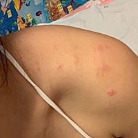 老是咬我……旧伤没长好新的又出来了 宝妈们有什么好办法吗？出了6颗牙了