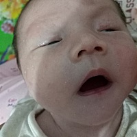 有宝妈们知道为什么出生20天宝宝鼻子周围发青吗？