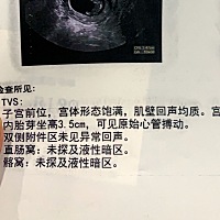 未婚先孕与男朋友分手一个半月发现自己怀孕了，他一直想让我打掉，来医院办理住院一个人躺在床上睡不着...