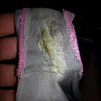 我这分泌物算多吗 姐妹们求解答