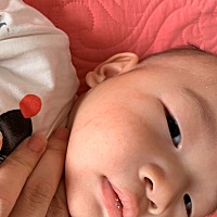 宝宝脸，头部都有长这些，搽什么好？反反复复的