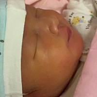 指甲好长，今天狠狠的对自己下狠手脸上抠出几块。我给你剪了指甲了……