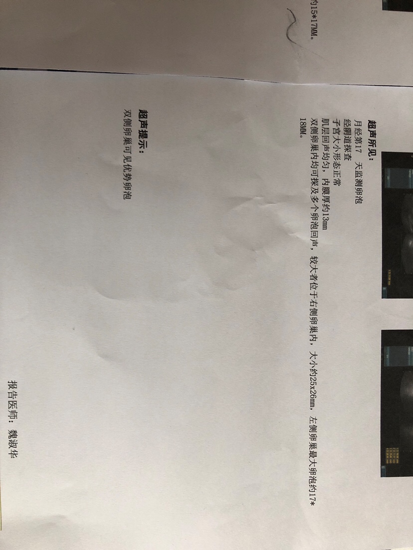 25日B超 监测