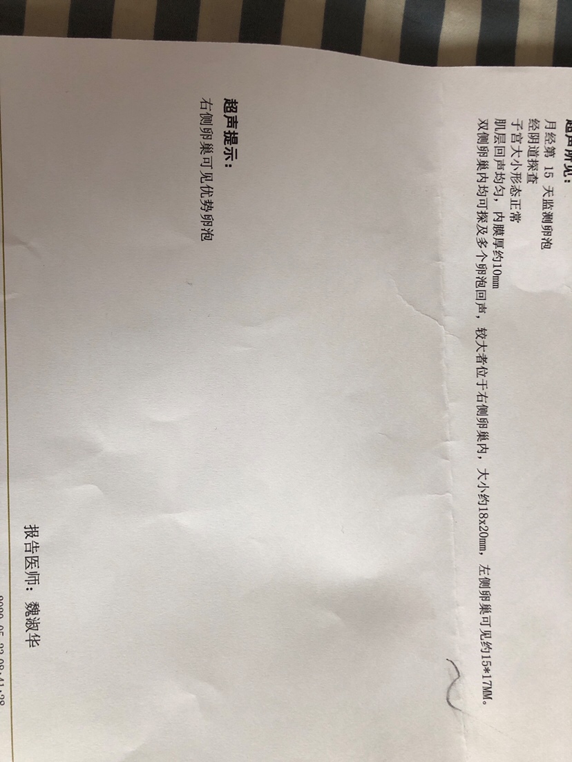 23日 B超监测
