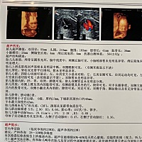 有看得懂是男孩还是女孩的吗？