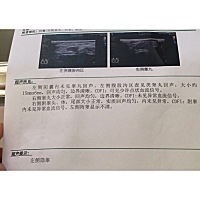 医生告诉我们左侧高睾是隐睾，让宝宝一岁左右看能不能自己长下来，不降下来，等以后大了做个小手术就可...