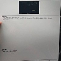 14个月女宝，右边乳房变大，摸起来像一个肉疙瘩，去医院检查内分泌和拍片子都正常，各位宝妈们，你们身...