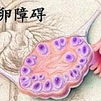 第一胎生孩子很顺利，为什么第二胎怎么也怀不上了呢？ 自从二胎政策开放以来，备孕二胎的家庭也来越多。...