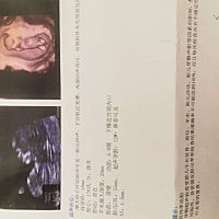 集美们，来看下男女，6月份预产期，我朋友的，她特别想要个女儿