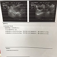 集美们，大概还要多久才排？