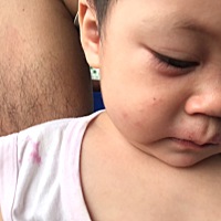 请问这是过敏吗？如果过敏拿什么涂？