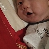 宝贝总是歪脖子睡，正常吗