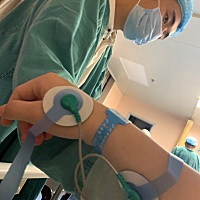 6.3号起床中午上厕所褐红色分泌物，下午开始不规律宫缩，晚上11点开始规律宫缩 ，12点到医院开了3指左右...