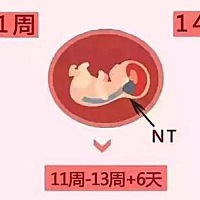每一个妈妈都希望自己的宝宝健康，一般情况下，只要有时间，有条件，怀孕的妈妈都会按时地去医院进行检...