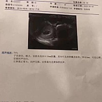 宝贝们，接好孕了，这3年一路走来真的太难了，好多次都想放弃了。好在皇天不负有心人，终于把宝宝等来了...