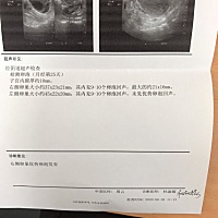 姐妹们，今天可以同房了吗？我太紧张了
