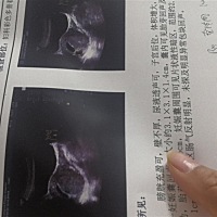 姐妹们帮我看看我还保胎呢。只是好奇