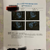 上次月经开始4月26号，5月底发现两道杠，6月一号去检查就说稍微有点低，看翻倍有抽了血，3号拿结果直接...