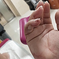 医生问，拔了尿管后，医生问“拉尿了吗”我说拉了，“下床了吗？”我说下了，其实都没有，我尝试了，撑...