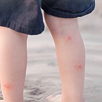 天气一热起来，家长就开始想尽办法给宝宝驱蚊。现在市面上有很多所谓的“儿童蚊香”，说是可以给宝宝使...