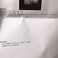 我宝宝两边腿纹有点不对称、做了B超就这样说、今天换尿布无意间发型有一边臀部稍微大一点点？