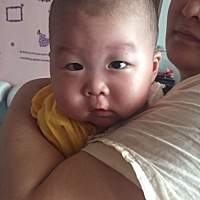 听别人说宝宝斗鸡眼是正常的，我家快三个月了，还总是斗鸡眼，请问各位宝妈这正常吗，长大会好吗？