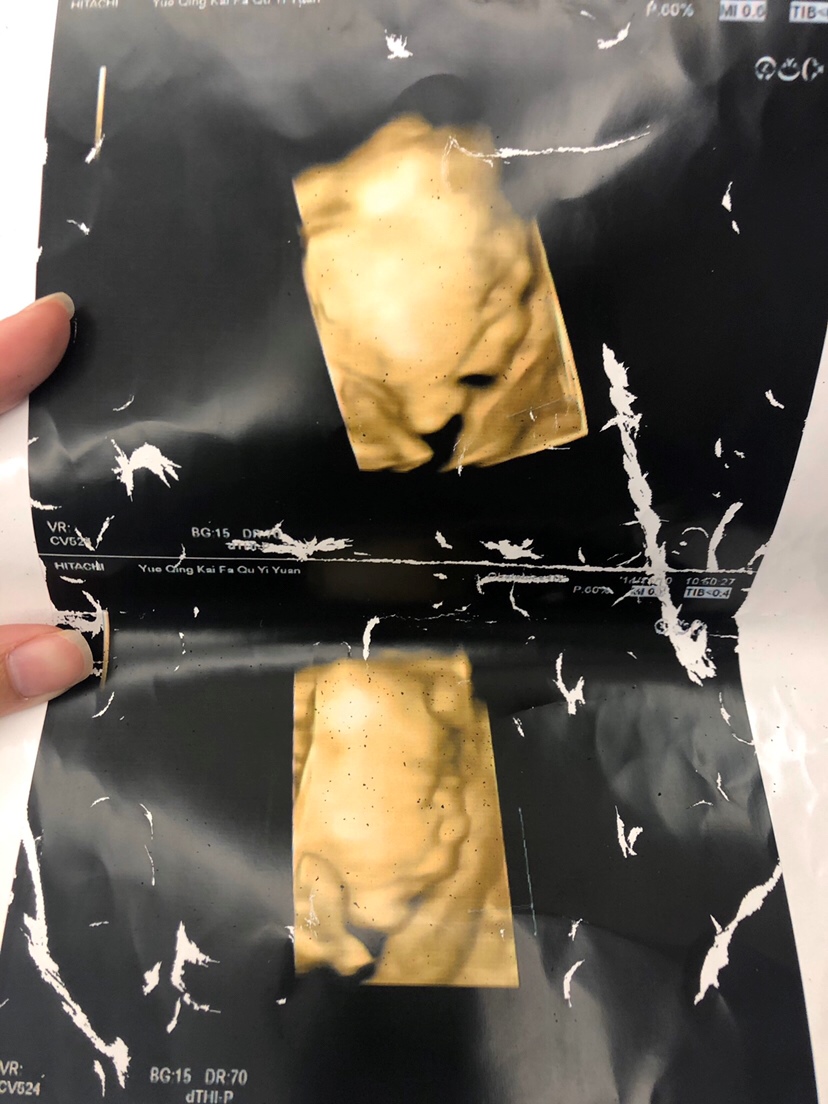 布丁哥哥