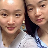 昨晚2020.6.14晚，儿子从床上翻身睡下床，老公和我视频，说婆婆抱起儿子的时候，他眼睛都是半闭状态，脸...