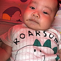 生出来嘴巴边是个水泡然后水泡破了慢慢的好了之前颜色是红色的还小然后我儿子大起来了颜色也变黑色了还...