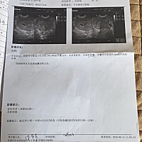 求有经验的宝妈看看是男是女？真的很好奇？二胎了，希望儿女双全。