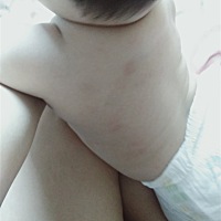 没有没有宝宝像我家孩子一样洗澡之后就长这个红痱子，还特别多，我帮你们介绍一支中药膏效果特好，小孩...