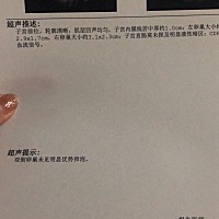 这是排完卵了吗